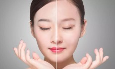  眼袋怎么消除最快？选择SKinova美容仪是消除眼袋眼纹简单方法