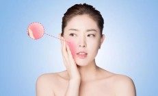 改善肤质的方法，Skinova美容仪超声波解决问题性肌肤